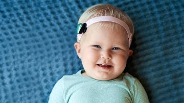 How Cochlear™ Baha® Start works