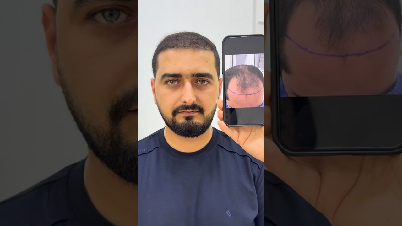 Video Önizləmə