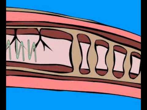 Кровеносная система дождевого червя