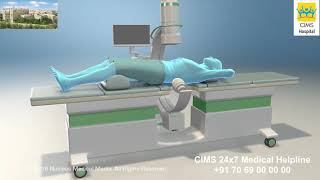 Extracorporeal Shock Wave Lithotripsy (ESWL) – CIMS Hospital