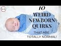 10 Weird Newborn Quirks