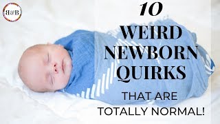 10 Weird Newborn Quirks