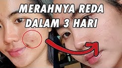 AMPUH BANGET BUAT BEKAS JERAWAT MERAH! i love centella asiatica - Durasi: 16.38. AMPUH BANGET BUAT BEKAS JERAWAT MERAH! i love centella asiatica - Durasi: 16.38.