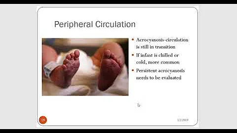 Adaptations of the Newborn part 1