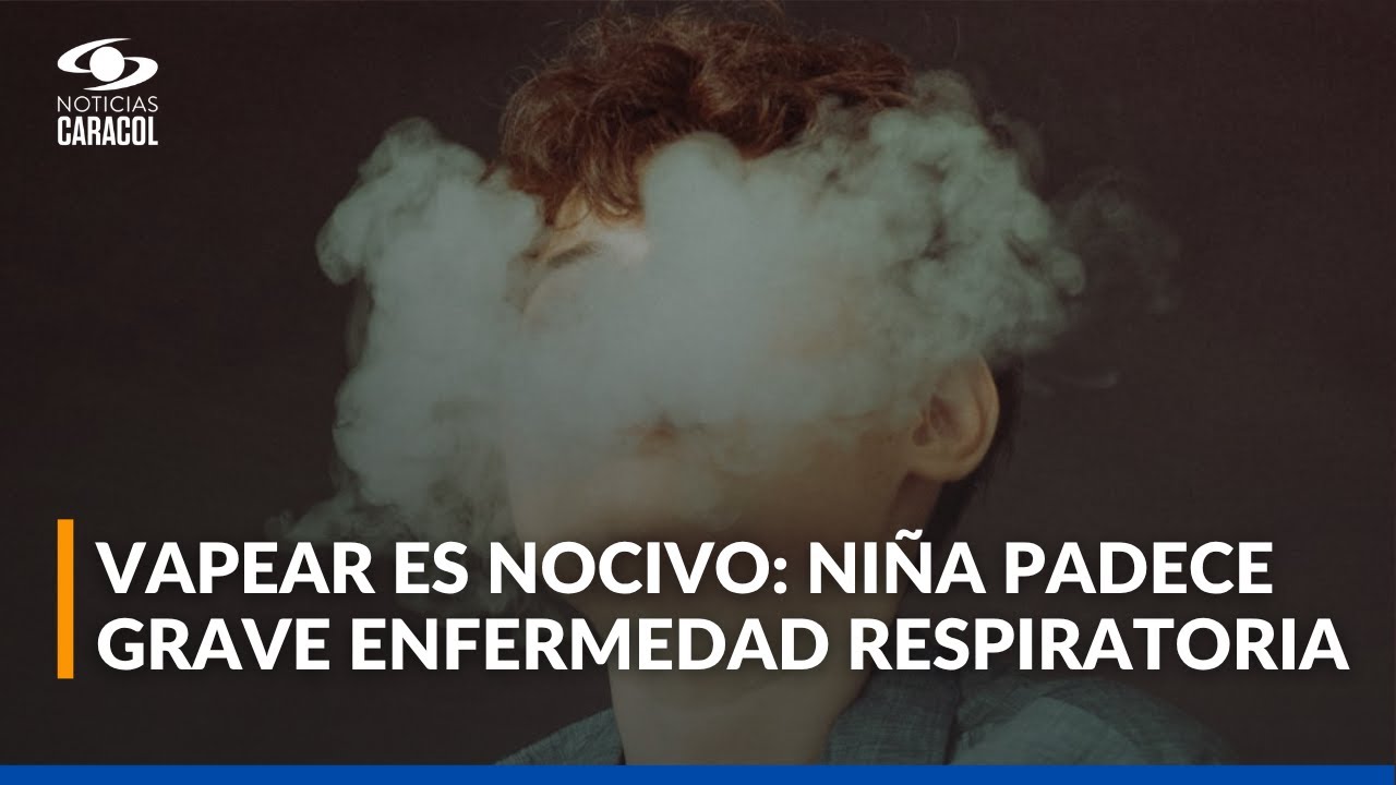 Por culpa del vapeador, menor de edad padece trastorno de ansiedad y una grave enfermedad