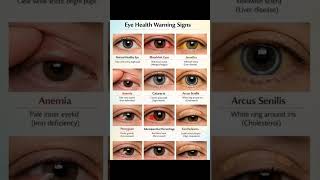 Eye Health Warning Signs | Eye Problems &amp; Symptoms Explained