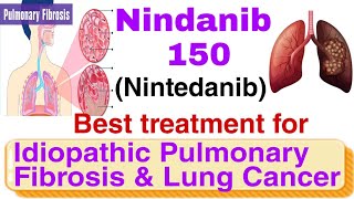Nindanib 150 ||Nintedanib 150 mg ||complete review||Usage, dosage, precautions,side effects||Hindi screenshot 4