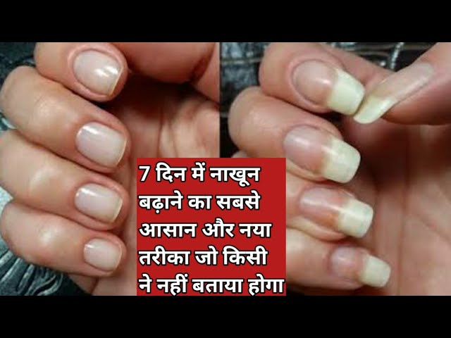 Nails Ko Jaldi Lamba Kaise Karen | Nails Badhane Ka Tarika | How To Grow  Nails Fast | Nail Care - YouTube