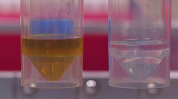 Human Organ-on-Chips