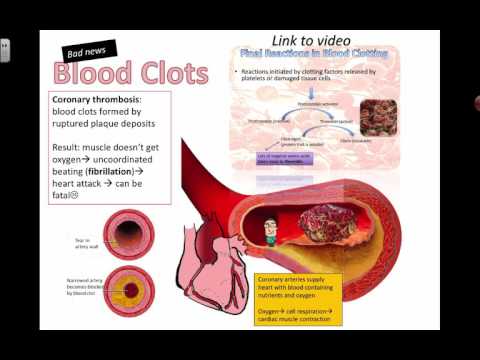 Video: Blood Clot In The Heart - Causes, Symptoms And Treatment