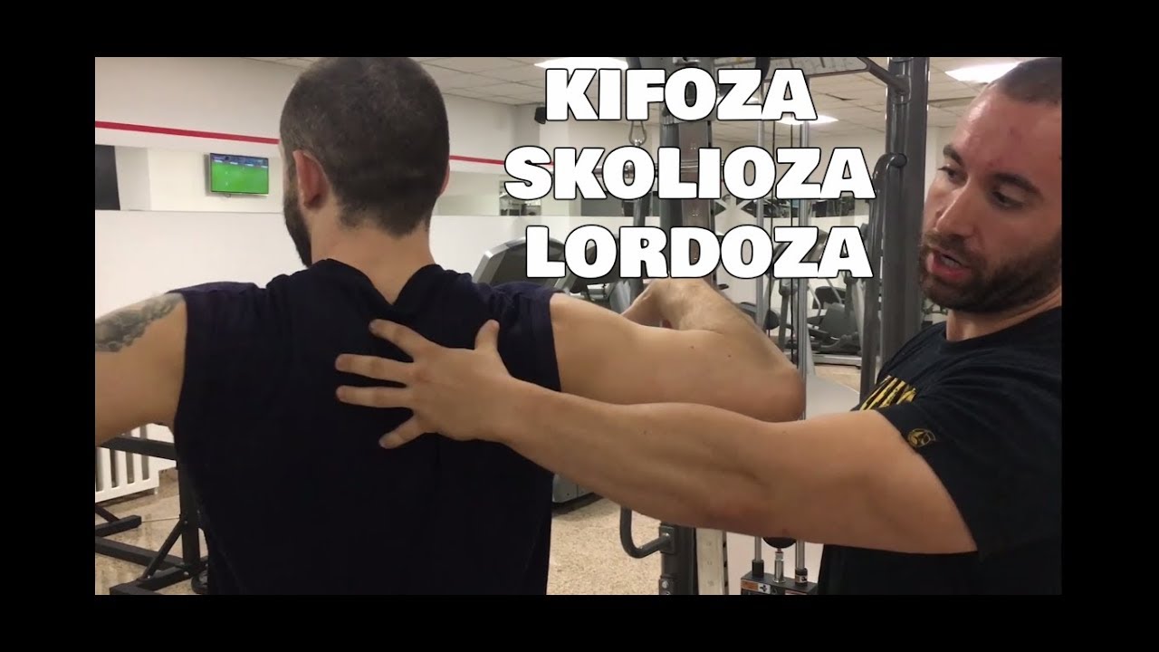 DEFORMITETI KIČME - Uzroci, posledice i kako ih se rešiti