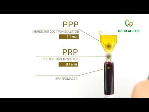 Забор крови для проведения PRP процедуры