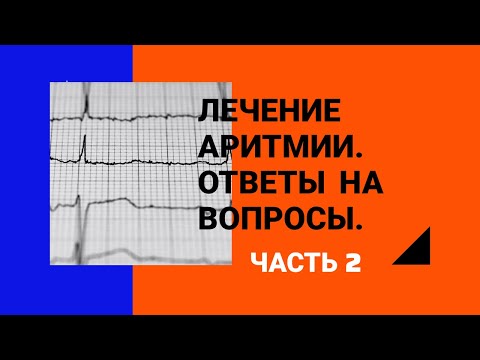 Лечение аритмии. Часть 2. Ответы на вопросы.