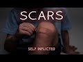 Scars self inflicted 01072024 2nd service