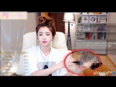 공짜로 양악하는 방법 전수한다!