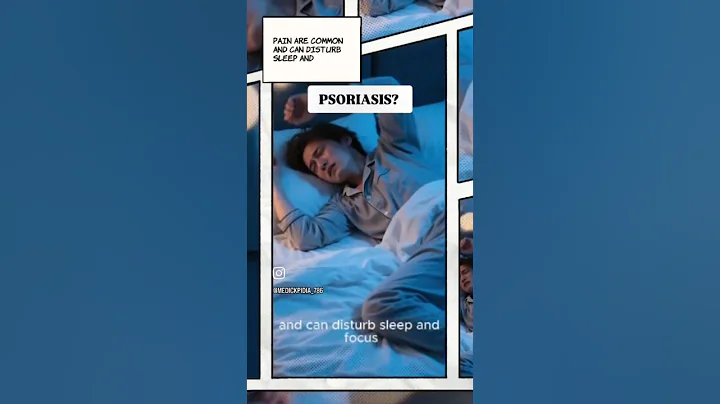 Do You Have These Psoriasis Symptoms? #shorts | Medickpidia