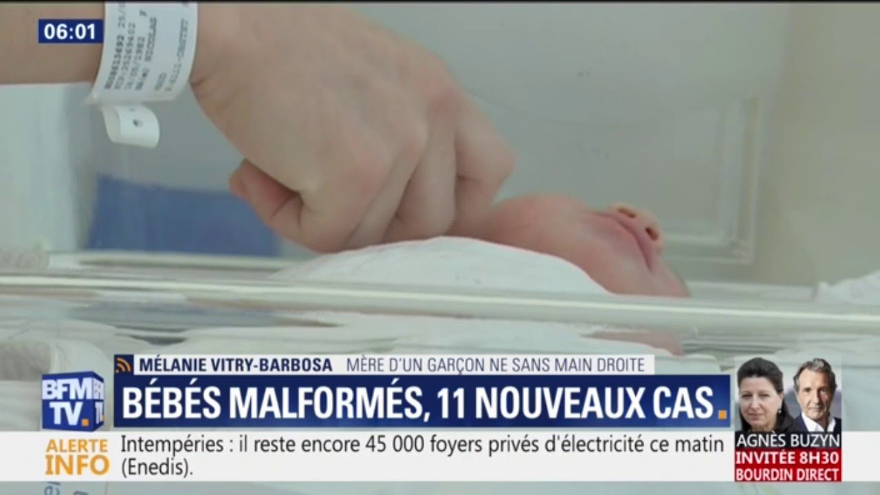 11 Nouveaux Cas De Bebes Malformes Le Mystere S Epaissit Youtube