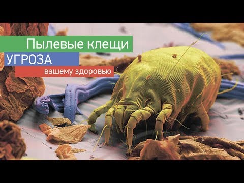 Пылевые клещи в вашей постели причина ваших болезней, убейте их с помощью этого простого решения