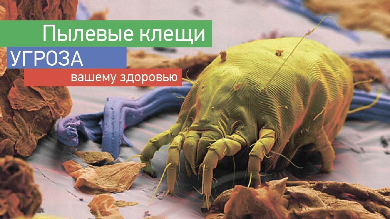 Пылевые клещи в вашей постели причина ваших болезней, убейте их с помощью этого простого решения картинки Пылевые клещи в вашей постели причина ваших болезней, убейте их с помощью этого простого решения картинки