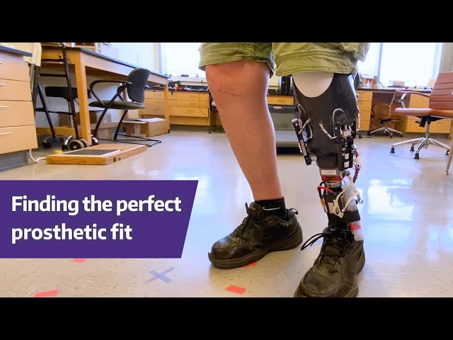 Cosmesis - Fashionable Prosthetics