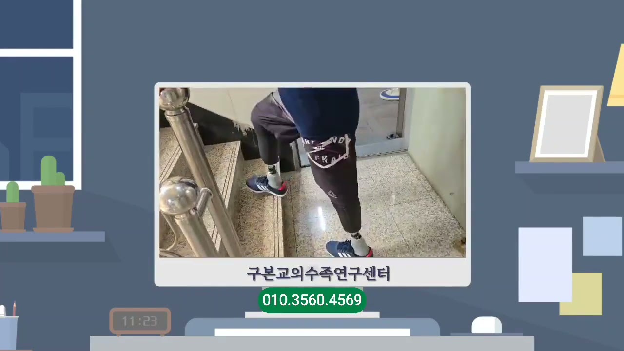 두다리 의족착용 