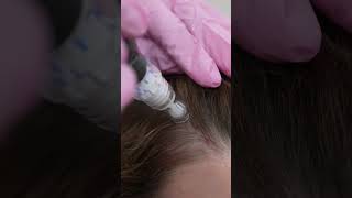ScalpMax™ is a 4-step, clinical-grade treatment for scalp wellness.