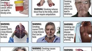U.S. Health Officials Look to Add Graphic Warning Labels to Cigarette Packaging