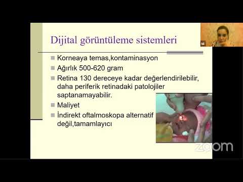 ANKARA ŞEHİR HASTANESİ GÖZ KLİNİĞİ's Zoom Meeting