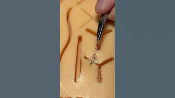 КАК ЗАШИТЬ РАНУ|SCALPEL.MED