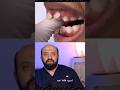 أسوء عادة .. خلي بالكم .. #dental #dentalclinic #dentist #orthodontics #اكسبلور #تجميلاسنان #ترند