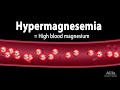 Hypermagnesemia: Causes, Pathophysiology, Symptoms, Diagnosis and Treatment, Animation.