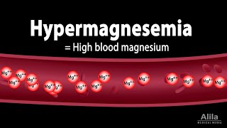 Hypermagnesemia: Causes, Pathophysiology, Symptoms, Diagnosis and Treatment, Animation.