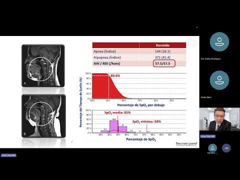 Webinar Sueño, Cerebro y Corazón