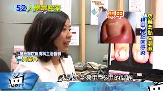 20171227中天新聞 人體實驗室 甲溝炎免拔指甲 無痛治療好夯!