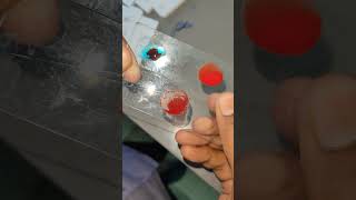 BLOOD GROUP TEST PROCESS ||DMLT_RAJ#DMLT#PATHOLOGIST#LAB#HOSPITAL#TECHNICIAN#SHORTS#VIDEO#MYCHANNEL