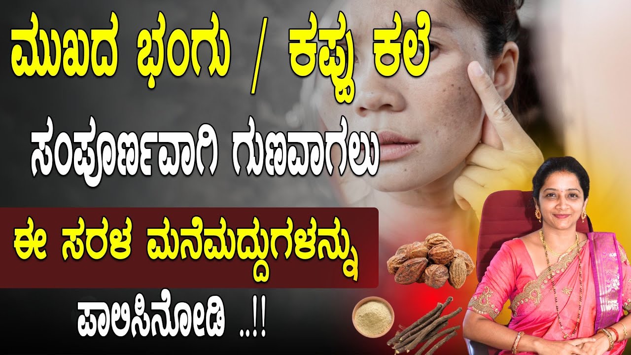 ಮುಖದ ಕಪ್ಪು ಕಲೆ  ಗುಣವಾಗಲು ಈ ಸರಳ ಮನೆಮದ್ದು | Remove Face Pigmentation Naturally | Bhangu in Kannada