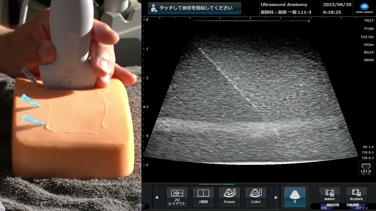 なぜ針先は見えなくなるのか？　エコーのビーム幅について