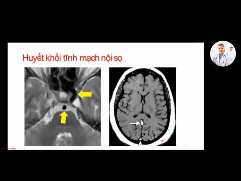 Video: Cách đọc MRI: 15 bước (có Hình ảnh)
