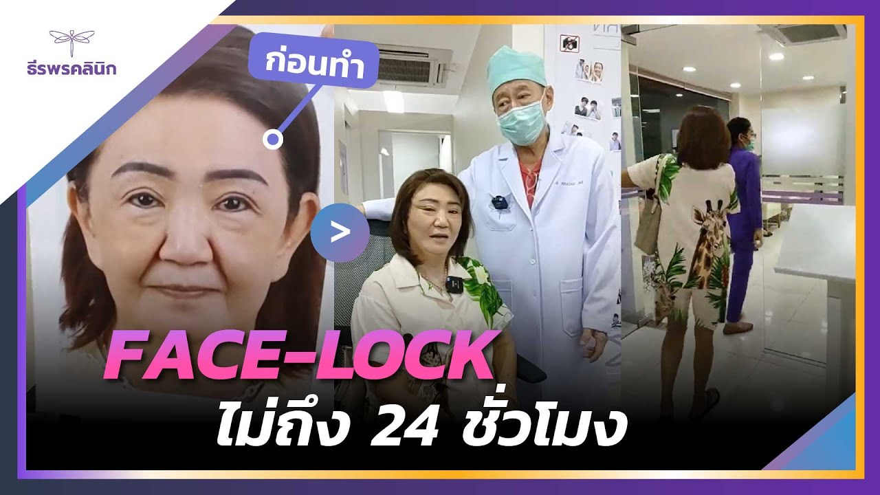 ทำตามาแล้ว 13 ปี ,Face-Lock ไม่ถึง 24 ชั่วโมง , พรุ่งนี้พร้อมทำจมูกไขมัน!!!! ธีรพรคลินิก หมอชลธิศ