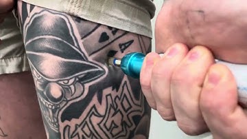 Testosterone , TRT without needles , 0.25 or 0.5ml