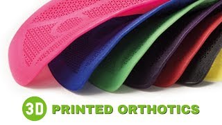 3D PRINTED FOOT ORTHOTIC INSOLES