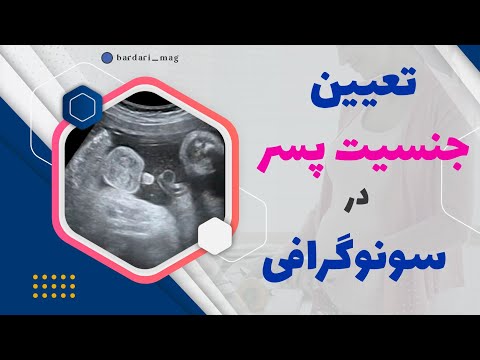 تصویری: در سونوگرافی نوزاد؟