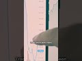 Roadmap Dreams vs Reality - 👇Register in Description 👇 | Profit On Chain