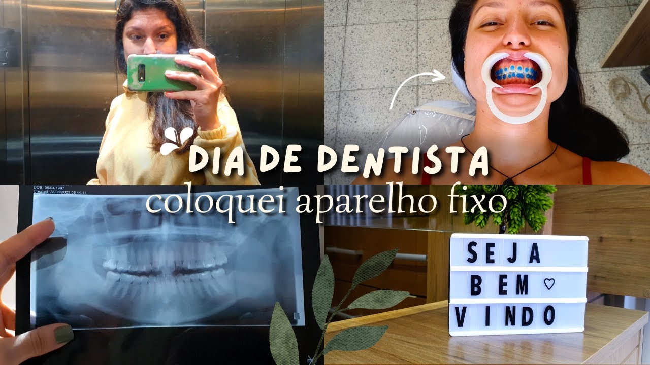 coloquei aparelho ortodôntico + primeiras impressões | VLOG 🦷✨