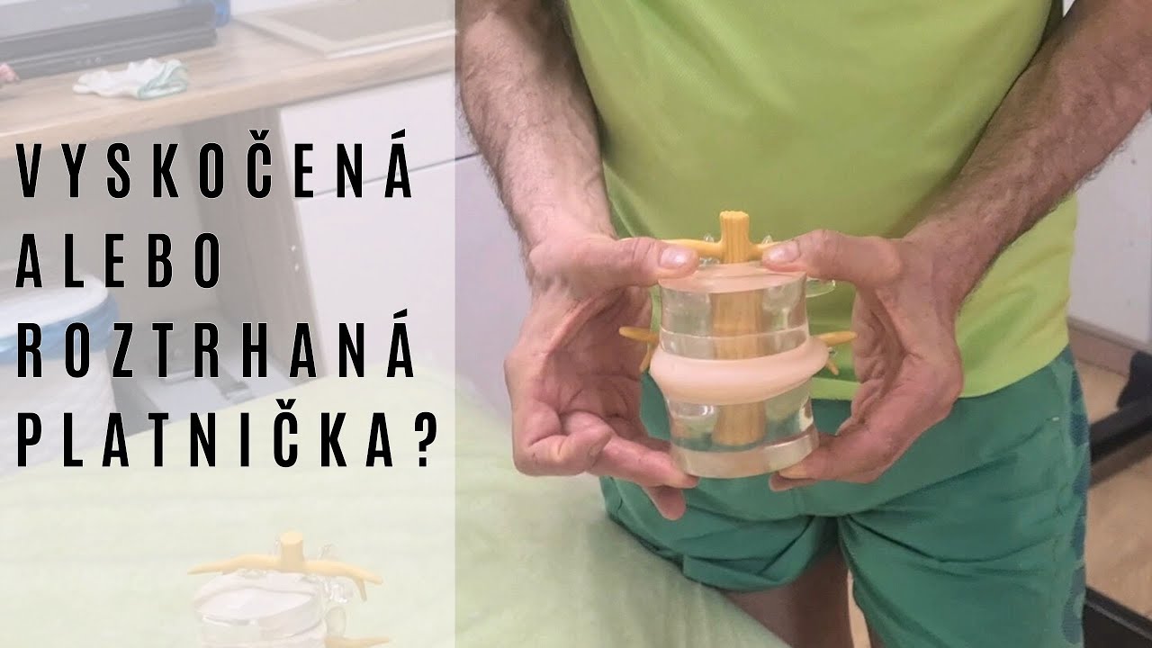 Vyskočená alebo roztrhaná platnička?