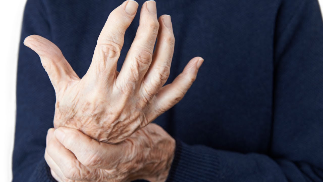 Artrite reumatoide: i 7 sintomi da non sottovalutare - YouTube
