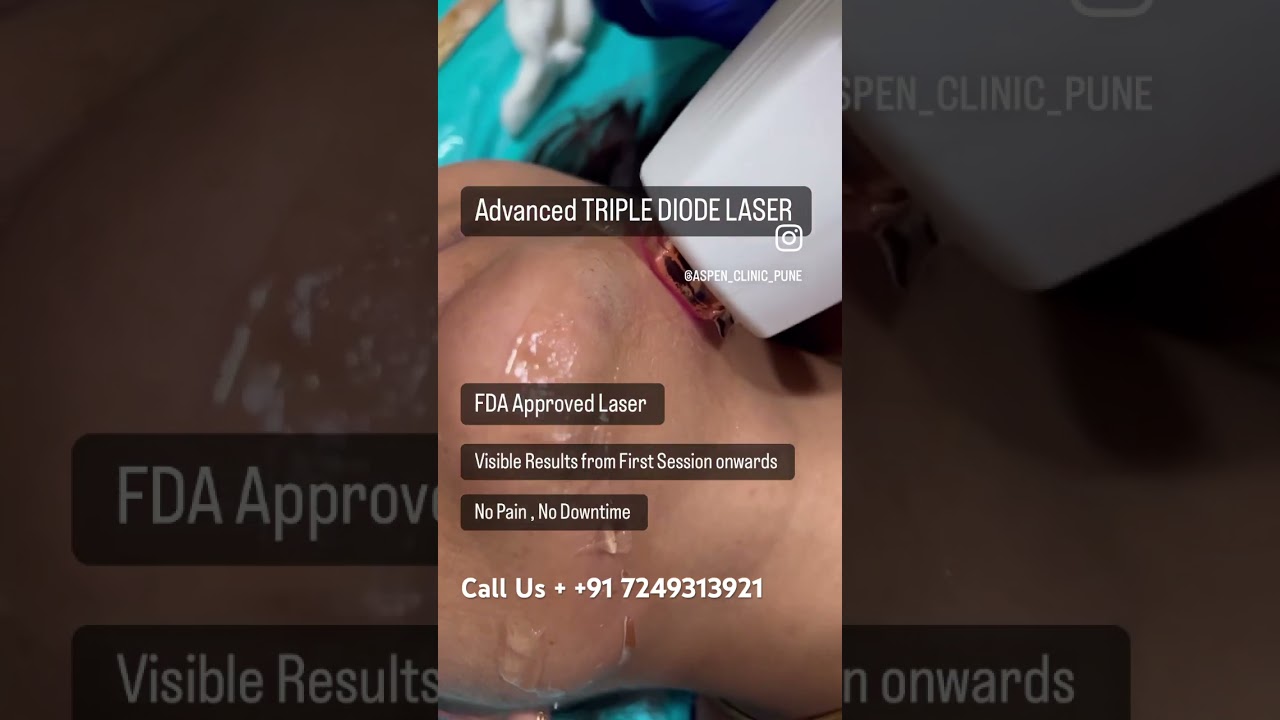 Facial Laser Hair Reduction Treatment by Advanced Laser at ASPEN Clinic by Dr Hina Khan, Pune