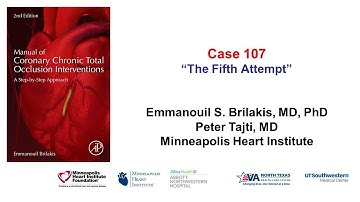 Case 107: Manual of CTO Interventions - The Fifth Attempt