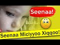 Miciyyoo Xiqqoo Seenaa Ajaa Ibaa 