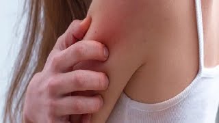 how to get rid of itchy skin all over your body fast